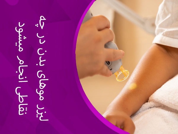 تصویر لیزر بدن در چه نقاطی انجام می شود